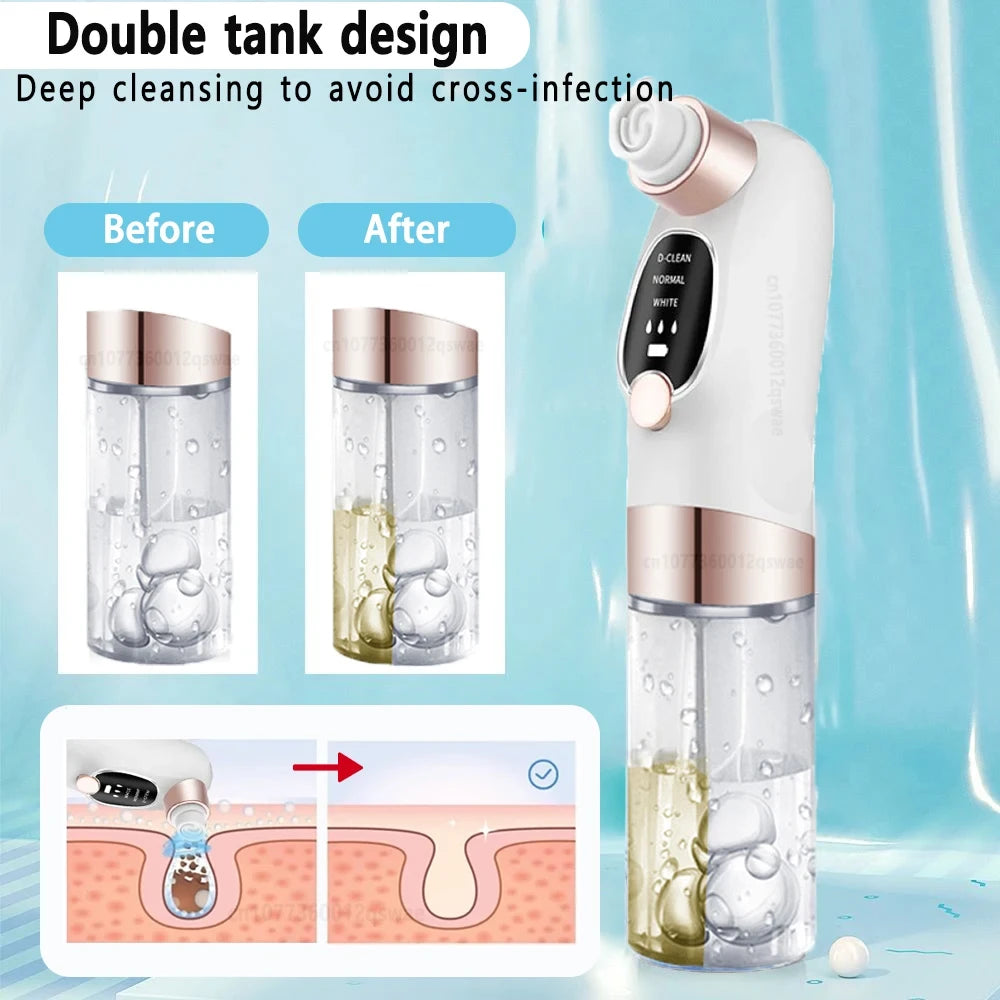 Electric Pore Vacuum Face Cleaner