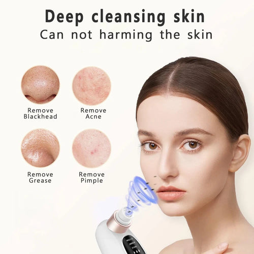 Electric Pore Vacuum Face Cleaner