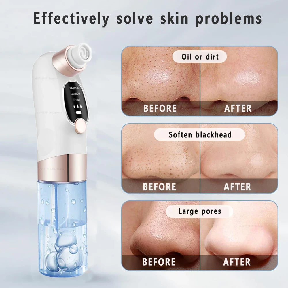 Electric Pore Vacuum Face Cleaner
